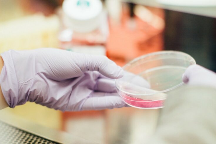 Gloved hand holding a petri dish