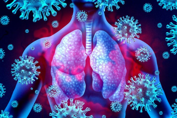 Lung virus infection and coronavirus outbreak