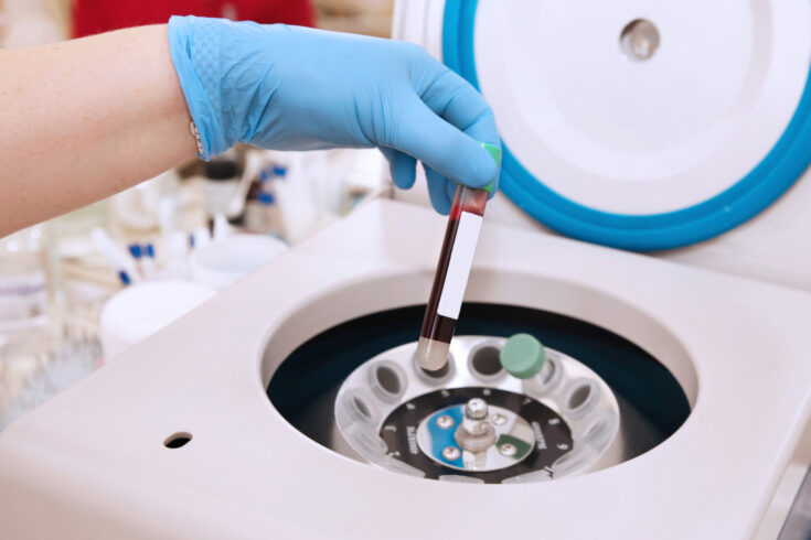 Blood sample being put into lab centrifuge