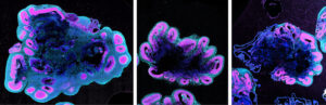 Human brain organoids grow substantially bigger than gorilla and chimpanzee (left to right). These brain organoids are five weeks old.