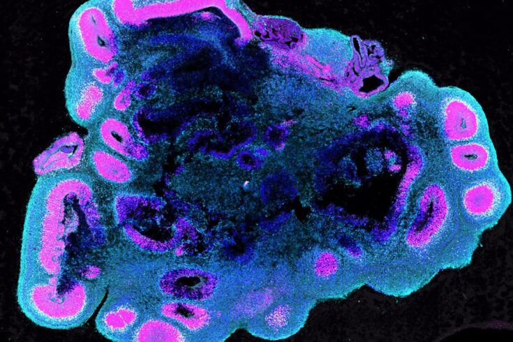 Human brain organoids grow substantially bigger than gorilla and chimpanzee. These brain organoids are five weeks old