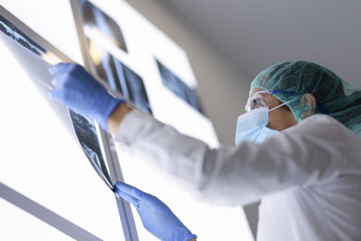 Female doctor looks at x-ray of patient in operating room