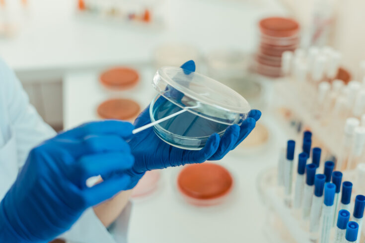 Selective focus of a transparent petri dish