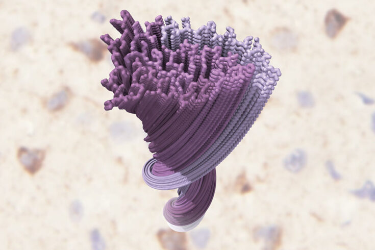 The newly discovered structure of clumped TDP-43, from the brains of people with ALS.