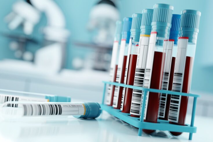 Blood Test Results In A Medical Lab
