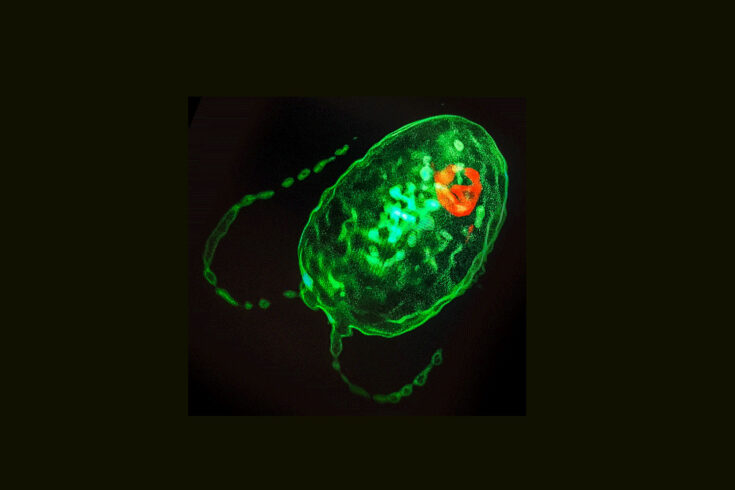 A single celled green algae containing a pyrenoid.