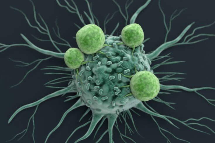 A cancer cell being attacked by lymphocytes