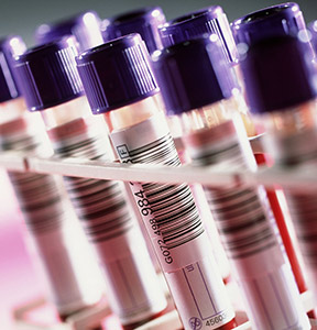 Blood sample tubes