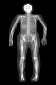 Full body x-ray showing skeleton