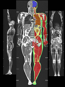 Body scans