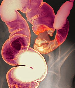 Section of bowel