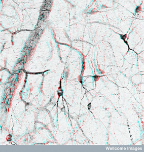 Nitric oxide staining in the brain