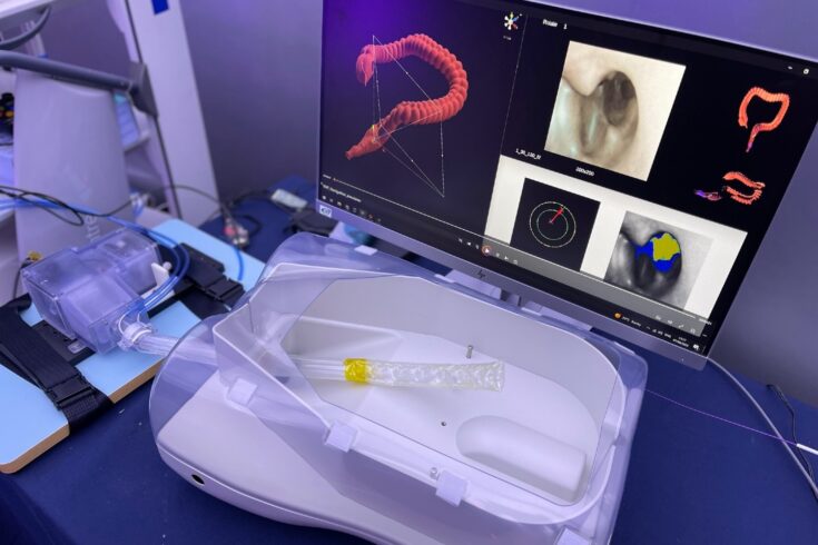 A self-propelled robot endoscope that can film medical procedures inside the body