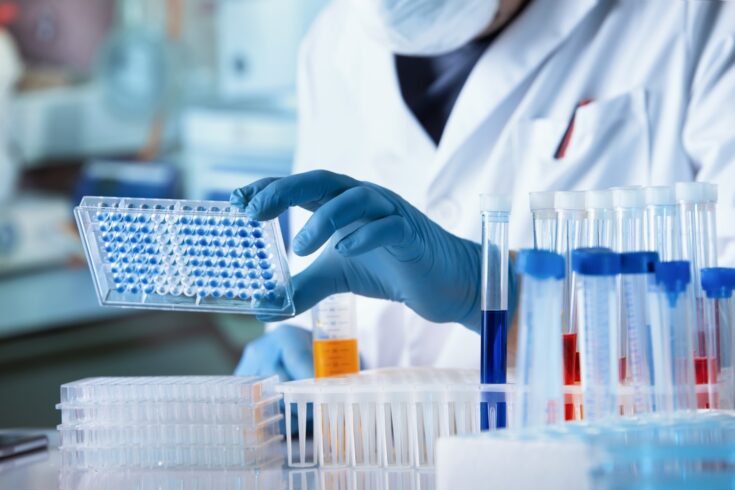 Researcher working with microplate panel for diseases diagnosis in the laboratory.