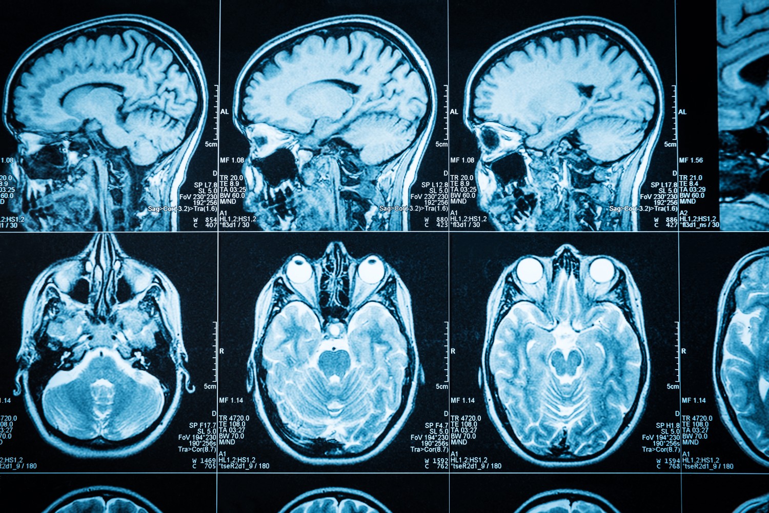 Research platform to transform treatment of traumatic brain injury – UKRI