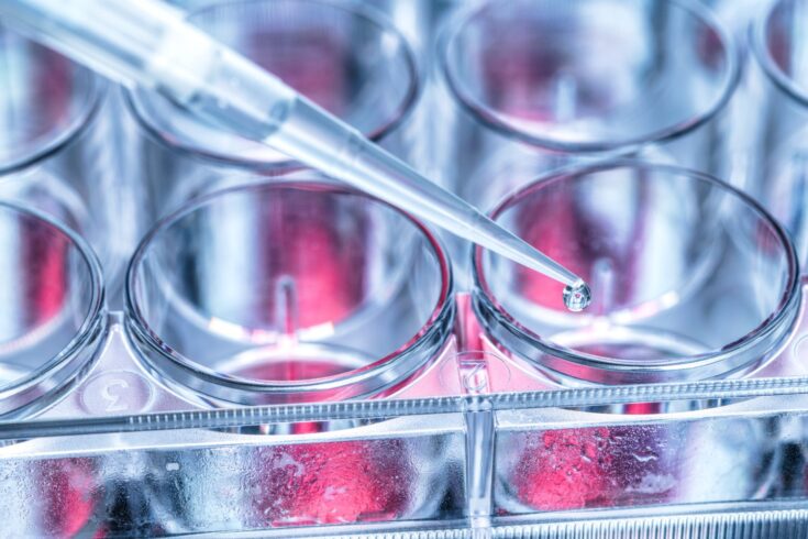 Scientist pipetting sample into a multi well plate