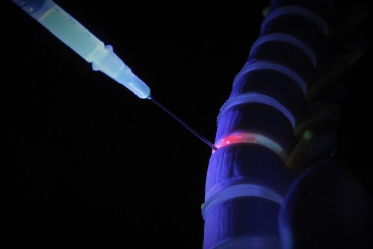 An image illustrating the use of injectable clay gels for biologic delivery in spinal fusion.