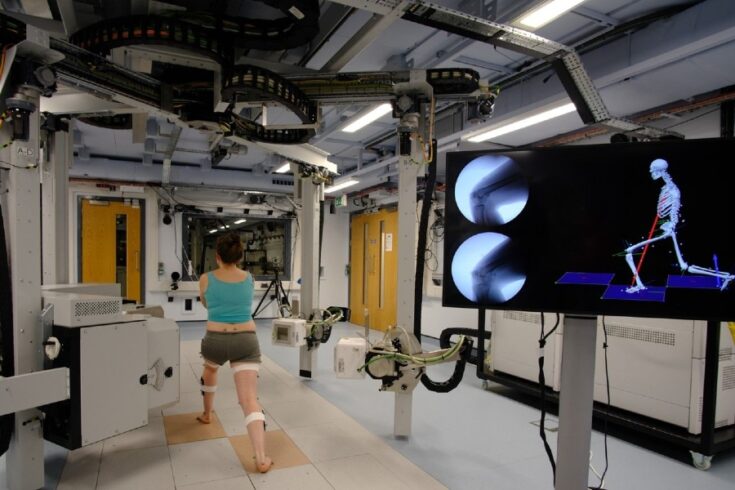 Woman lunging while being monitored and X-rayed. A nearby monitor shows the X-ray and imaging of the woman's spine and legs.