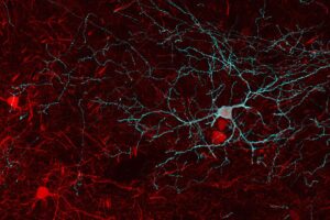 Neurons in the brain