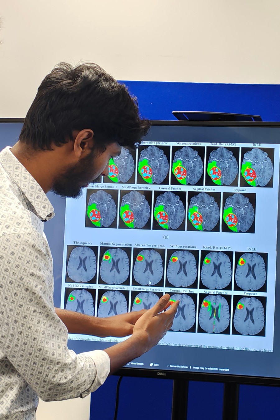 Man looking at images of a brain.